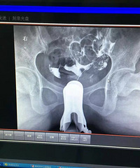 �������ѹ���Ӱ��� ҽ��ֻ������һ���ҩ �ж�������