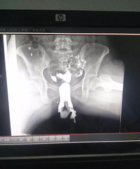 �������ѹ���Ӱ��� ҽ��ֻ������һ���ҩ �ж�������