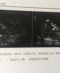 ��ά���������������׼�����ɿ��� ���...