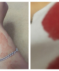 ������˵ܵ�һ�� ͷ�ŵؿĵ�������Ѫ