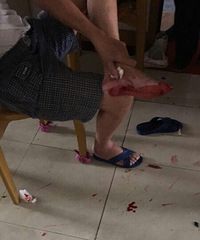 ��ɷ������ͻȻð�̱�ը׹�� �鲣�������ϲ���