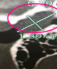 ����5�꺢���ͿŶ�ʺ����5000��Ǯ��