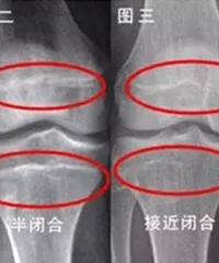 14���к�����û������ �ְ�ȴ˵���Ҽ�4�׷����������Ρ���