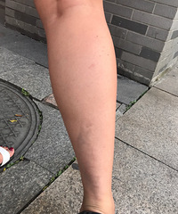 �ҷ��ˣ����˴����õ�ƿ�������ռ��λ...