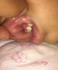 �����ı�������������� �����ϻ������촽����