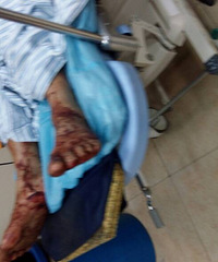 �����ͳ��۷�����Ѫ�¼� ���޳���˫���ֵܽ���������