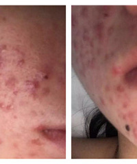 ���в�3���� ���Ͼͳ�����ô�ර��