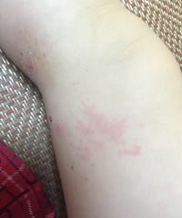 ��������һ��Ƭ�� ���ʲôƤ������