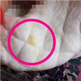 ����֮ǰ����Ⱦ�� �󳦰�ϣ��