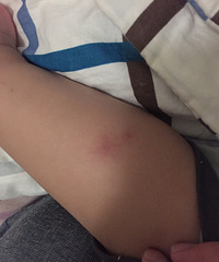 һ������ С���ӽžͱ�ҧ�������� ��������