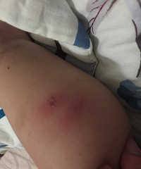 һ������ С���ӽžͱ�ҧ�������� ��������