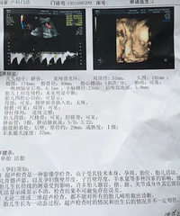 ��̥��ҩ���ѵ�����ȥ5�� ˳���������һ�� ���ᰡ