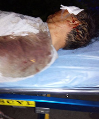 �ң��賿���ӾƼݵ�ƿ��ײ�ϸ���� �۾���������