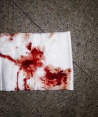 �ң��賿���ӾƼݵ�ƿ��ײ�ϸ���� �۾���������