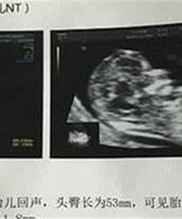 ���ҿ�����Ů����˵̥��120���б���