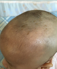 ����´�Ӥ��ͷ���а�ɫ�߿�