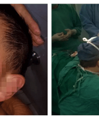 �к����ھӼҵĹ�ҧ��������Ѫ ����50����