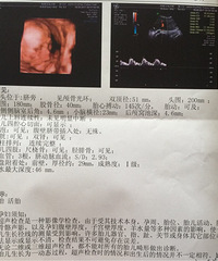 ��ά���Ż� ����7����ȥ��ҽԺ ����������ۡ�