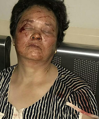 ������Ѯ���˱���������Ѫ����˵���־�Ȼ�Ǵ�ѧ������