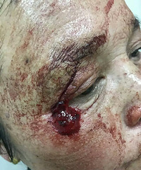 ������Ѯ���˱���������Ѫ����˵���־�Ȼ�Ǵ�ѧ������