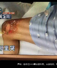 ������Ӿ�� ���Ӻ��������� ������ һ���������Ƥ����ŧ..