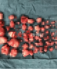 ��������Ҫ�õ�4�������� ҽ���������ӹ��󾪴���