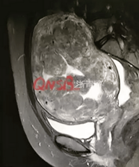 ÿ�������ٶ��õ����İ�������,ҽ���������ӹ��󾪴���!