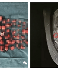 ������Ҫ�õ�4�������� һֱδ�� ���ӹ�...