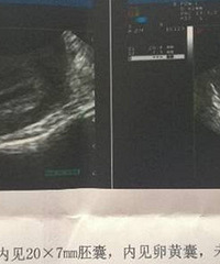 ���ģ�����40�� �п���ɫ������