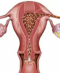 ���£�5��Ů����㱻�����ѳ�