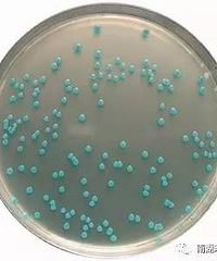 ����һλ��̥�����Ⱦ��˹�ؾ���ֻ����˿�ˮ��