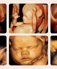 �����ĸ�ҽԺ����ά�����ѣ��ó̡��°�����1088