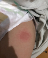 ����7��������Ī�����ֺ�� �������е�ӲӲ