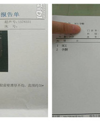 ������� ����Щ��Ѫ  b��ҽ��˵��̫�ã�