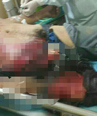 �ң�һ�����ھ��ѹ����ƿ�� Ѫ��ģ��