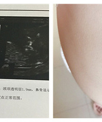 ���������ţ��һ����ˣ�ɹ�����Ӱɣ�