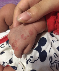 ����������Щ���Խ��Խ�� ��̥�ǻ���Ѫ������