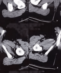 �ܺ��Ӿ���26�����������С���������п�����ҽ��ɵ��...