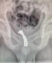 �ܺ��Ӿ���26�����������С������