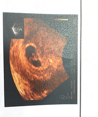 �������� ��̥סԺ�� ƨ�ɱ����������� �������ų��̲ˣ�