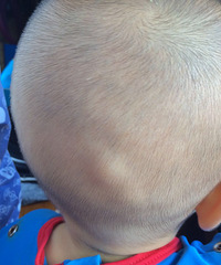 ����������ͻȻ����һ���� û�п��� û�����Ӷ�ҧ��