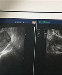 �����к���  ��ֻ̥��Ҫ��Ů����