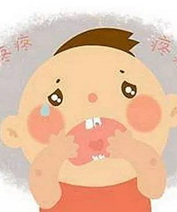 "嘉兴幼儿入园前体检 包茎、乳腺结节……查出不少问题!"