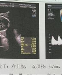 ��28+5��ˮƫ��  ��7.7 ���ˮ�ܲ���ȥ��