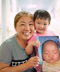 "99公益日,帮助唇腭裂的孩子,大家一起来"