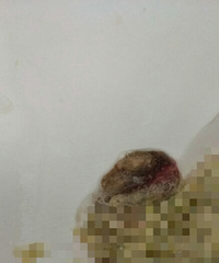 �������ص������Ѫ