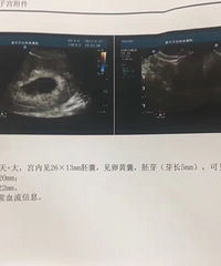 �Ϲ�ÿ�춼����ϴ�·�