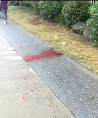 �����ײ�����ֳ������ֳ�֫����� ���϶���Ѫ