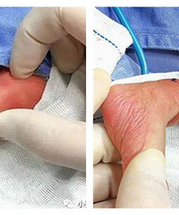 ����������ȱ��������� �����ͱ���֪����Ҫ��֫