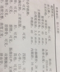 ��ά��ʾ̥��ƫ��